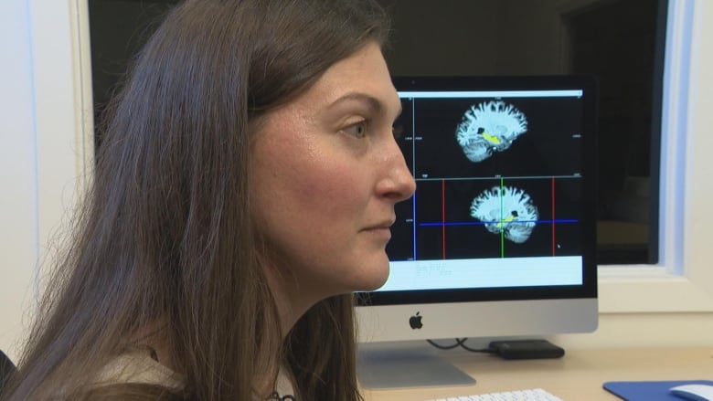 The side profile of a woman, sitting by a computer which is displaying an image of the brain.