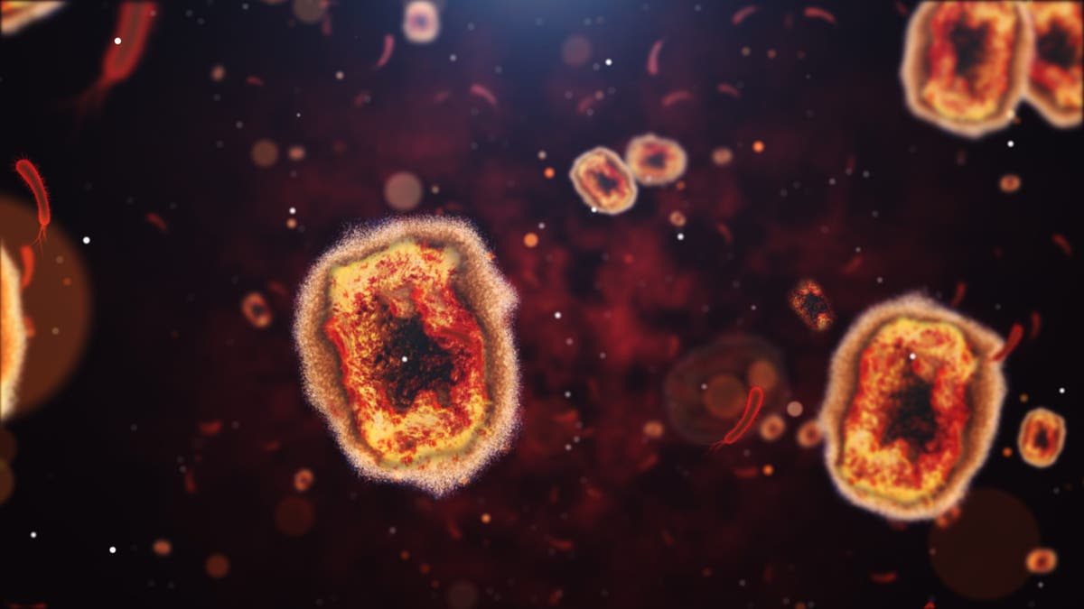 First known case of rare mpox strain confirmed in United States