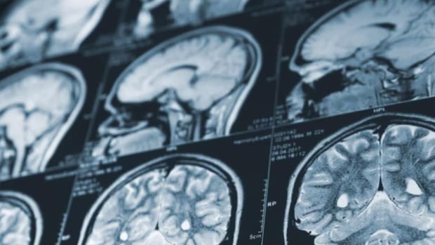 N.B. investigation into mystery brain illness to begin within months, says Susan Holt