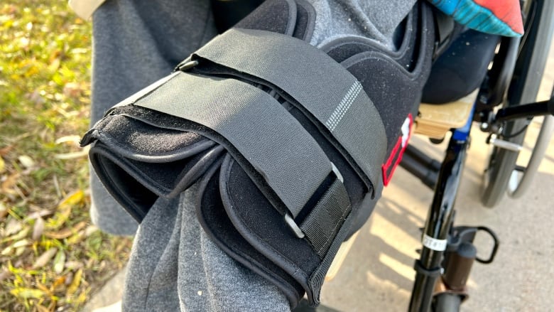 Review into amputation underway after patient says wrong leg removed at Grace Hospital
