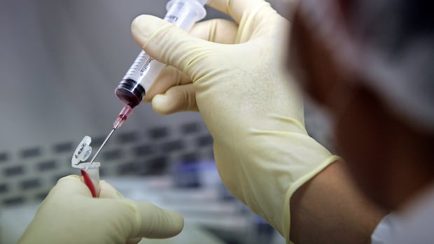 Thousands of donations, fewer than 2% used. Why cord blood transplants are so rare