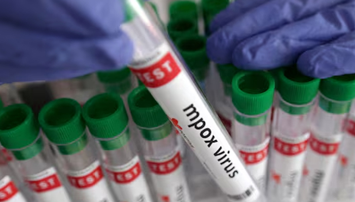 Three possible mpox patients sent home as tests return negative