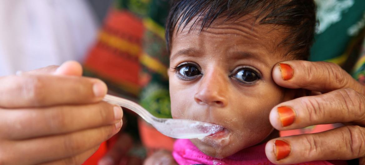 UNICEF seeks 5 million for therapeutic food to combat ‘silent killer’